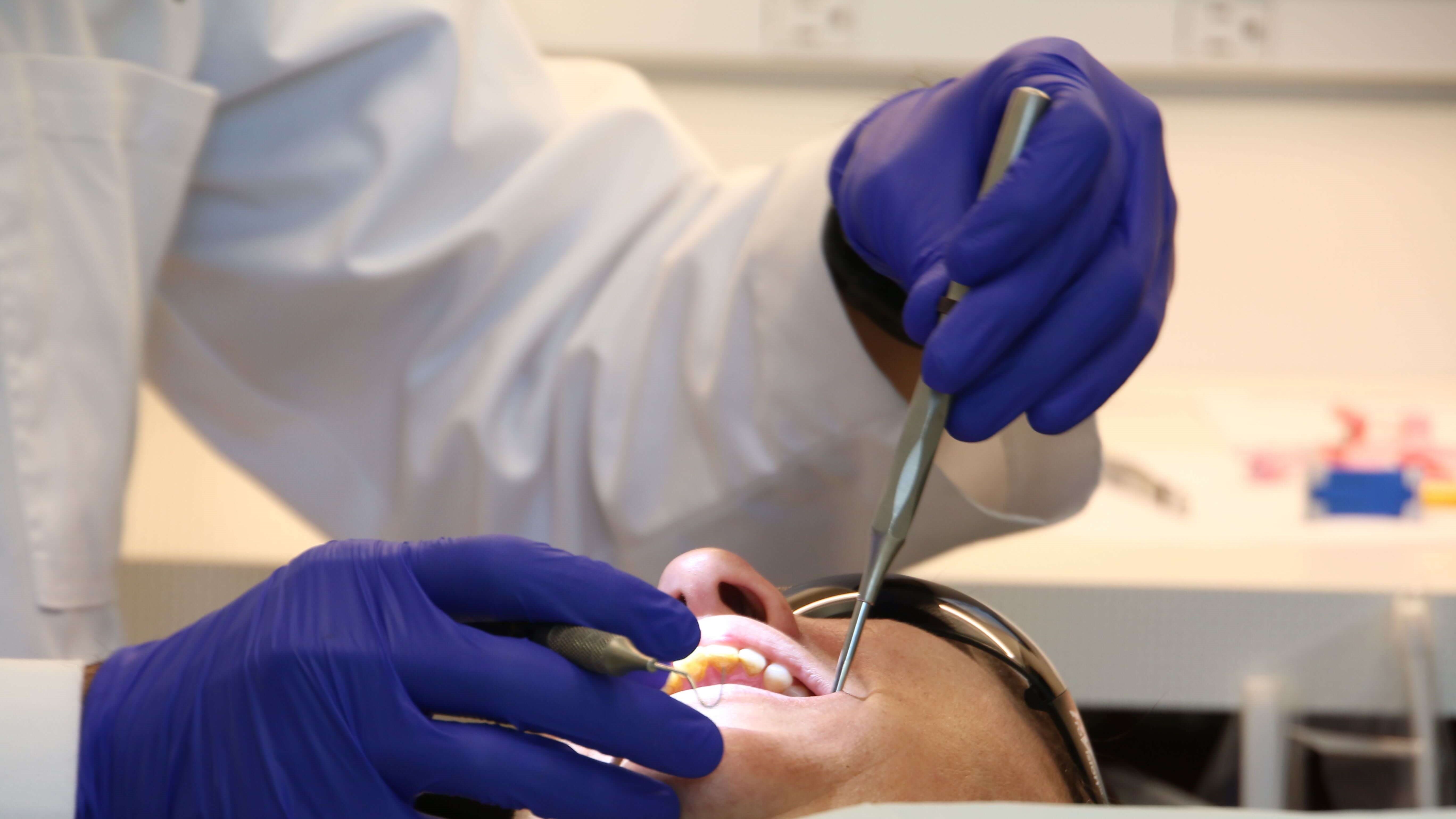 teeth cleaning